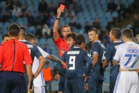 Чи справедливо отримав вилучення Малакян у матчі з «Динамо»?