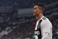 Роналду відкрив клініку з пересадки волосся в Мадриді