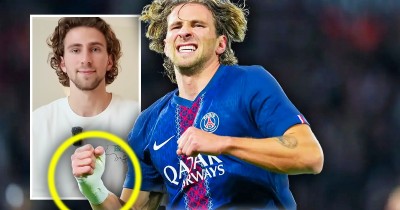 Забарний пояснив, чому виходить на матчі з перемотаною рукою – причина не лише у травмі